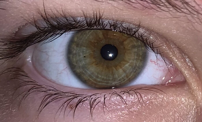 I Have A Whole Album Of My Eyes! It’s Slightly Misshapen, It’s The Eye I Can’t See Out Of Properly