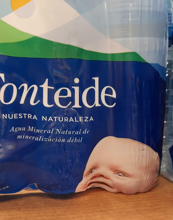 The Placement Of This Baby's Head Wasn't Quite Thought Through