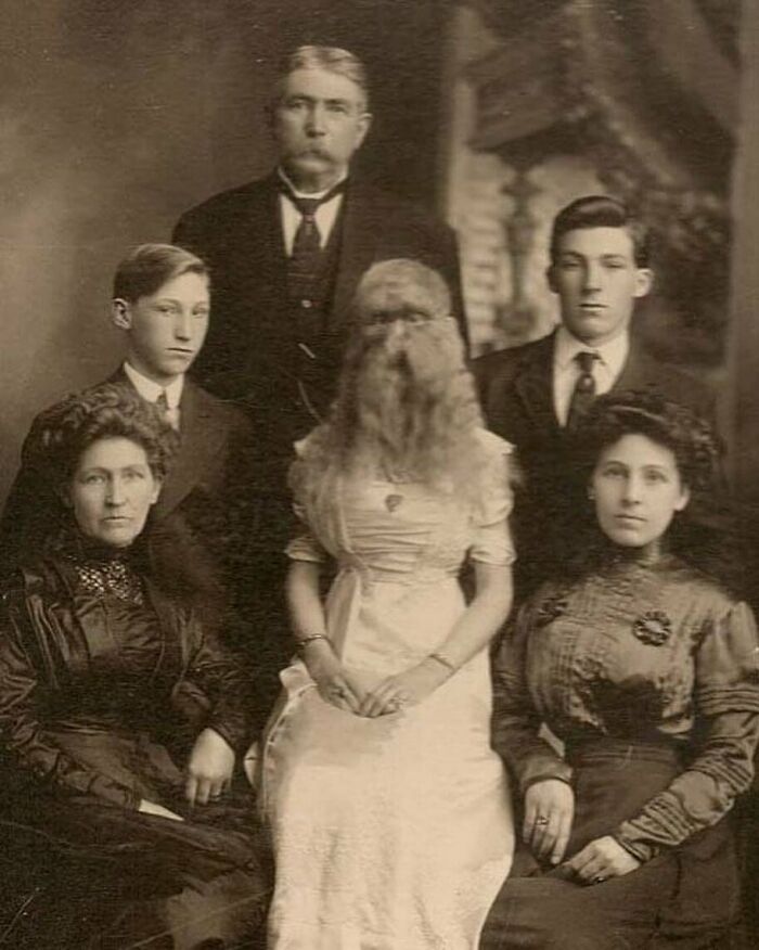 Alice Doherty - The Minnesota Woolly Girl - Poses With Her Family In A Typically Dour Victorian Photograph Circa Early 1900s