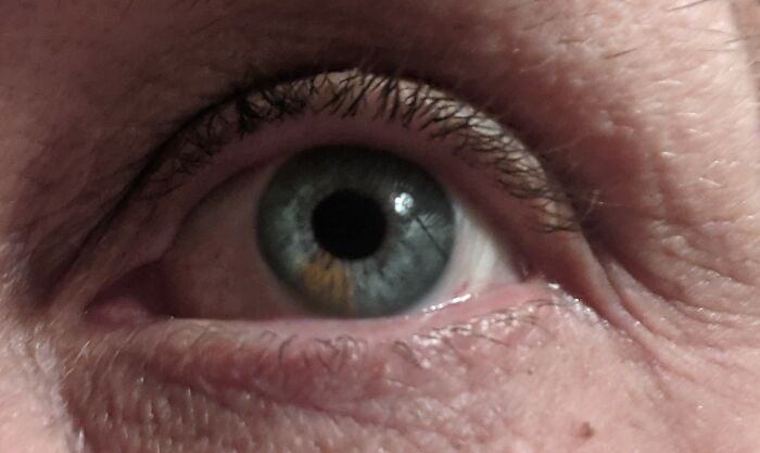 My Left Eye, I Have Brown In Both Of My Eyes But More In This One
