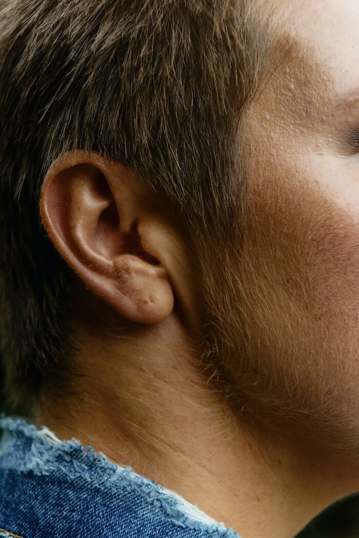 Persons Side Face And An Ear 