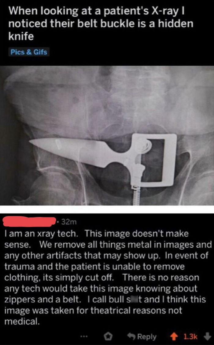 Guy Gets Called Out For Fake Xray