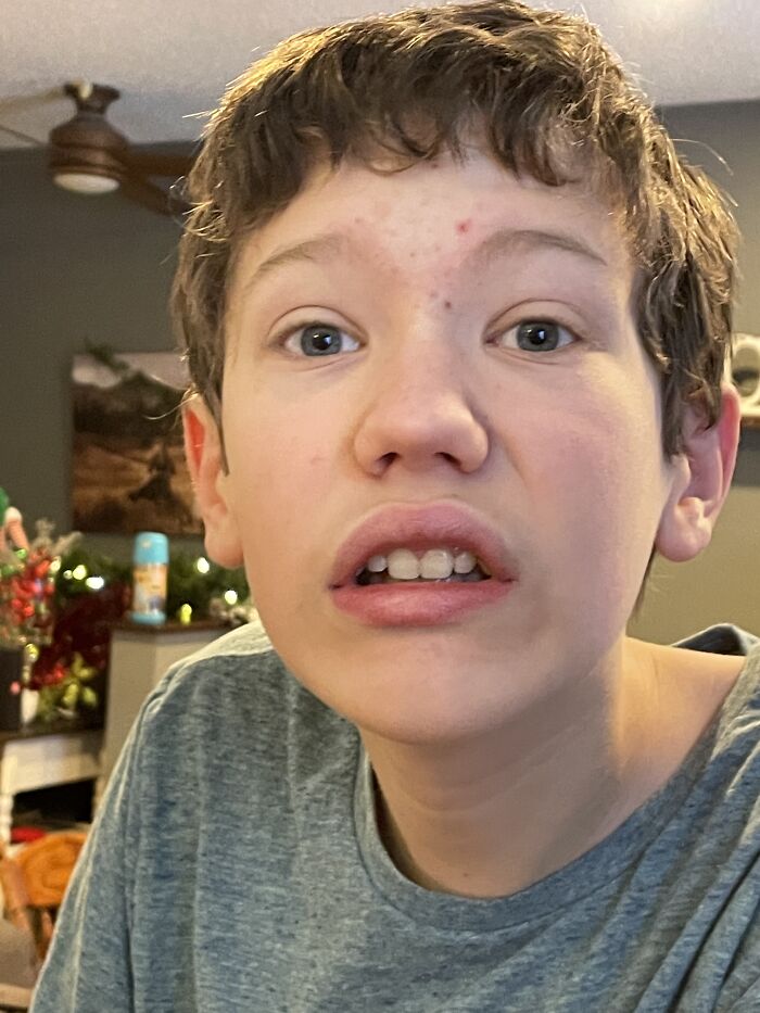 It’s His Fault He Posed Like This