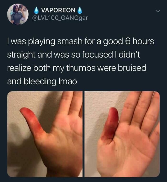 Looks Like They Dipped Their Thumb In Koolaid