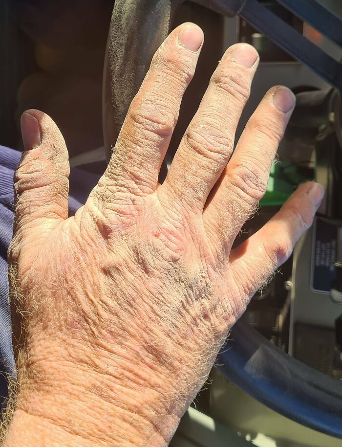 Hard Life For Hands In A Cement Manufacturing Plant. I'm A Maintenance Boilermaker And This Is After A Day Working In The Dust. Choose Your Profession Wisely