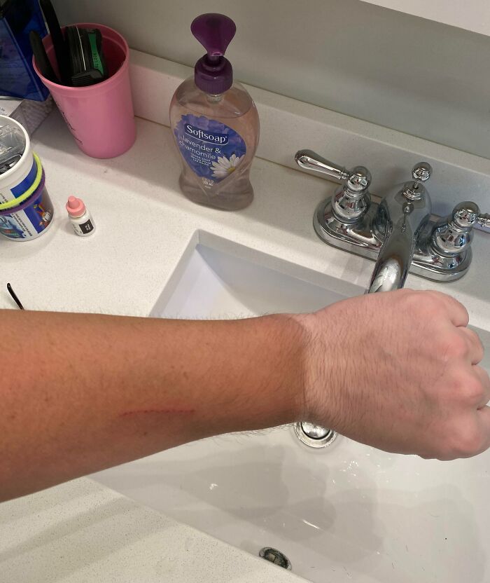 My Tan Line From Wearing Gloves At Work (Laborer On A Trash Truck)