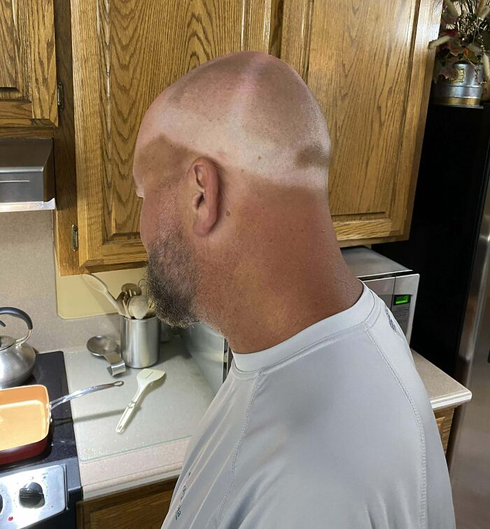 My Brother Works Outdoors, And Wears The Same Hat Every Day