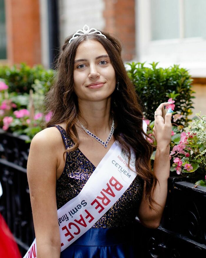 A Finalist Of Miss England Finalist Has Become The First Contestant To Compete Without Wearing Any Makeup In The Pageant's 94 Years Of History