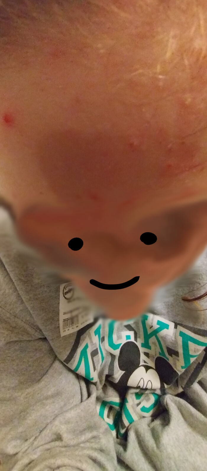 I Blurred Out And Smudged My Face Bc I'm A Minor Lol