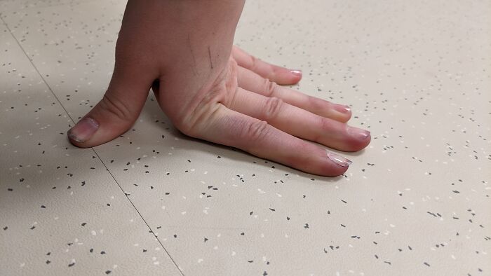 Fingers Can Go Past 90° Angle