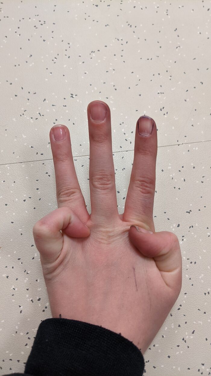 Bend My Pinky And Thumb Backwards