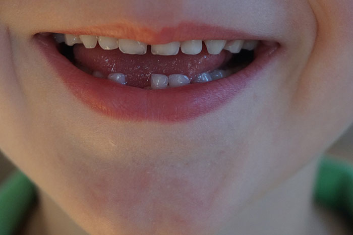 Close-up photography of child mouth