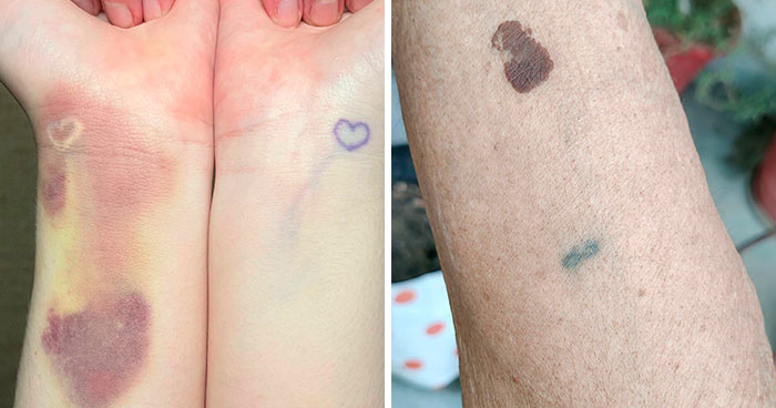 50 Times Tattoos Accidently Matched Perfectly With The Situation