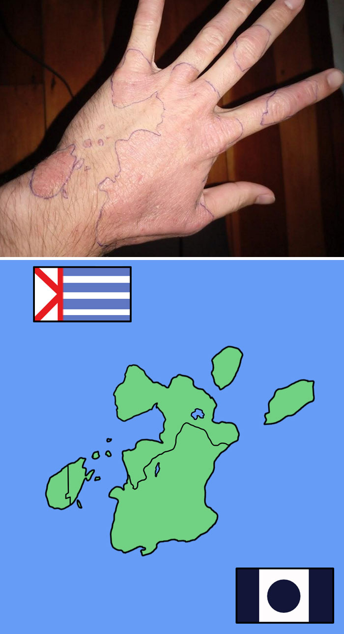 Eczema Mark On My Hand Looks Like A Landmass So I Turned It Into A Map