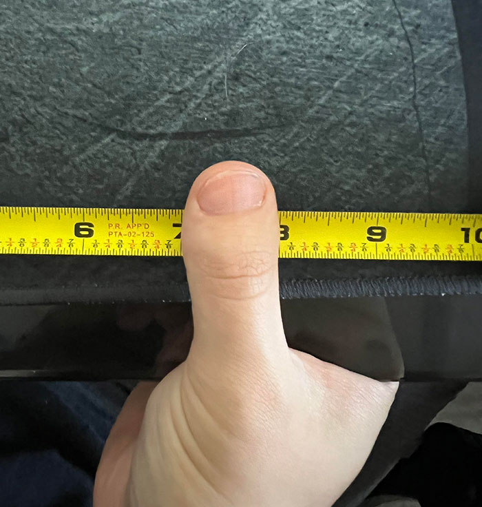 My Thumb Looks Like A Toe And Is Exactly 1 Inch Wide