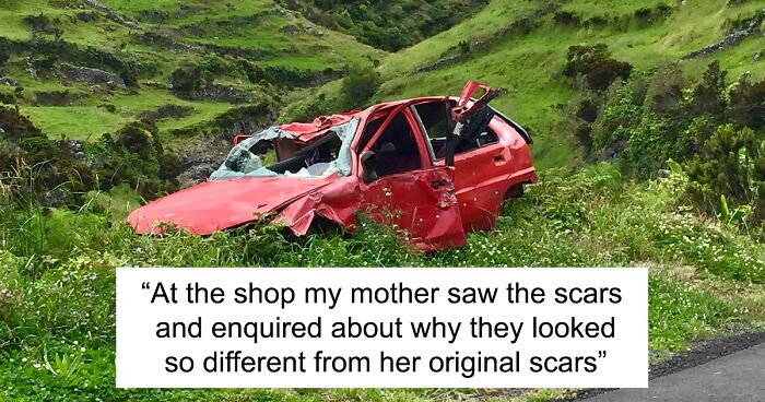 “AITA For Uninviting My Mother From My Wedding After She Called My Wife Indecent For Having Plastic Surgery?”