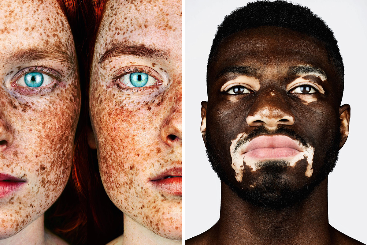This Photographer Brings Awareness To Diversity Through Portrait