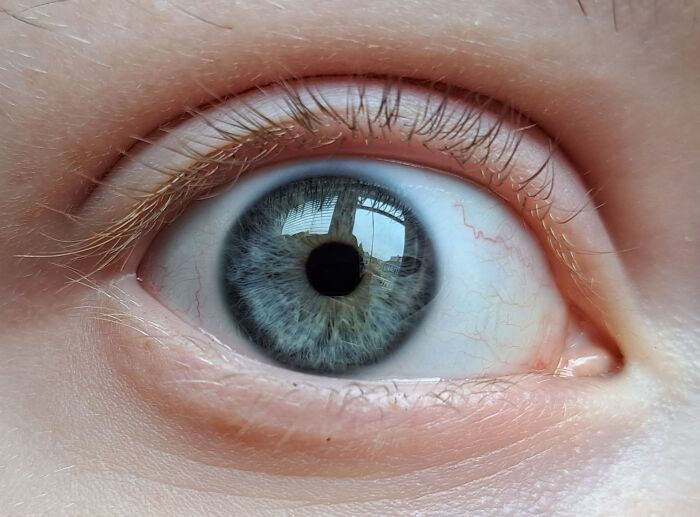 My Eye!