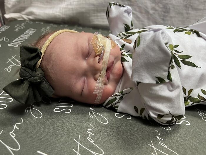 The Heart-Warming Story Of One Photograph: An Image Of A Baby With A Cleft Lip, Making Her Story Go Viral The Heart-Warming Story Of One Photograph: An Image Of A Baby With A Cleft Lip, Making Her Story Go Viral