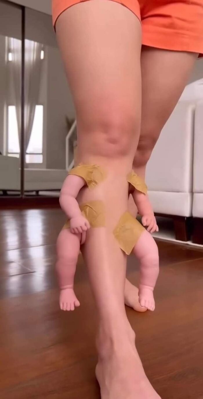 Doll Parts Taped To Someone’s Shin