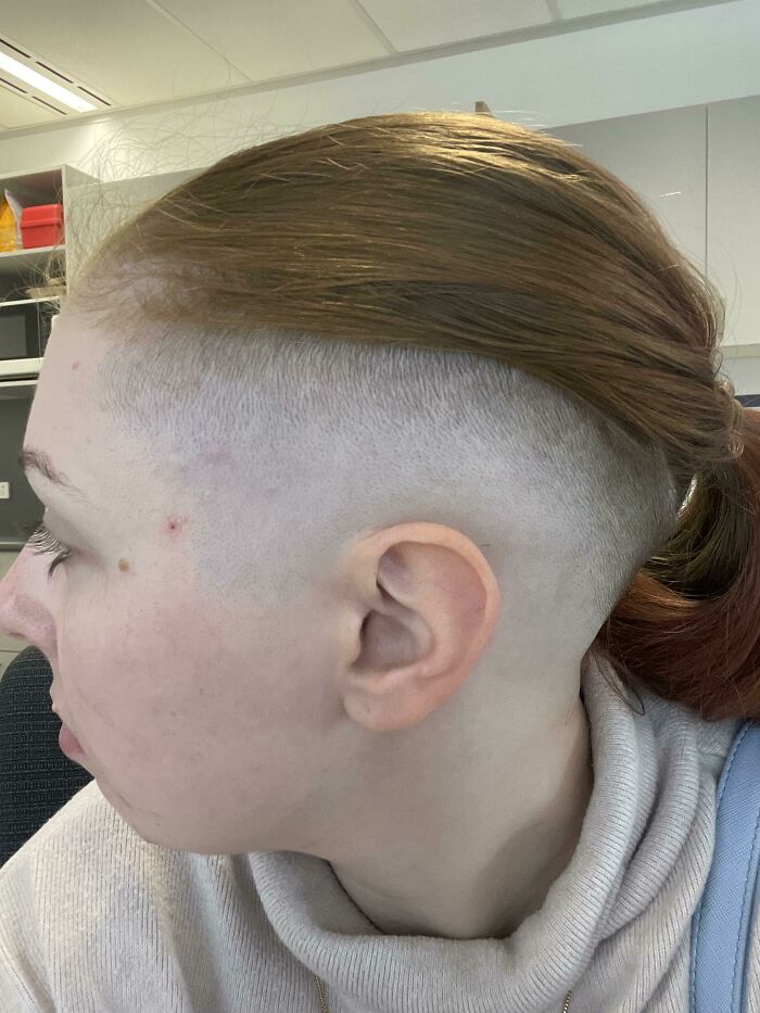Asked For A Fade On My Shaved Side And The Barber Took It All The Way To The Part. Half My Head Is Bald Now And I Work A Job Where I Can’t Put My Hair Down