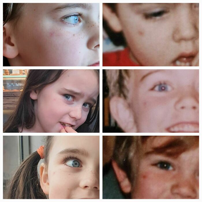 Mi hija tiene una marca roja en la mejilla desde hace años, exactamente en el mismo lugar en el que yo tuve una marca roja en la mejilla durante años cuando era niño