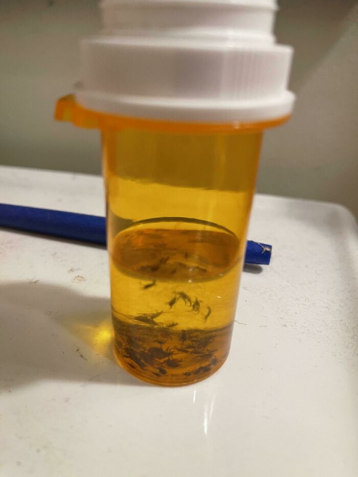 My Dad Keeps A Pill Bottle With 90% Alcohol In It To Kill Ticks (And Collect Them)