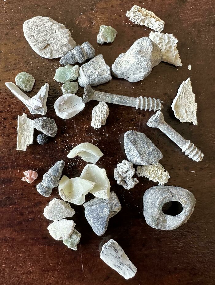 Some Screws, Teeth Bits, And A Filling Found In My Dad’s Ashes