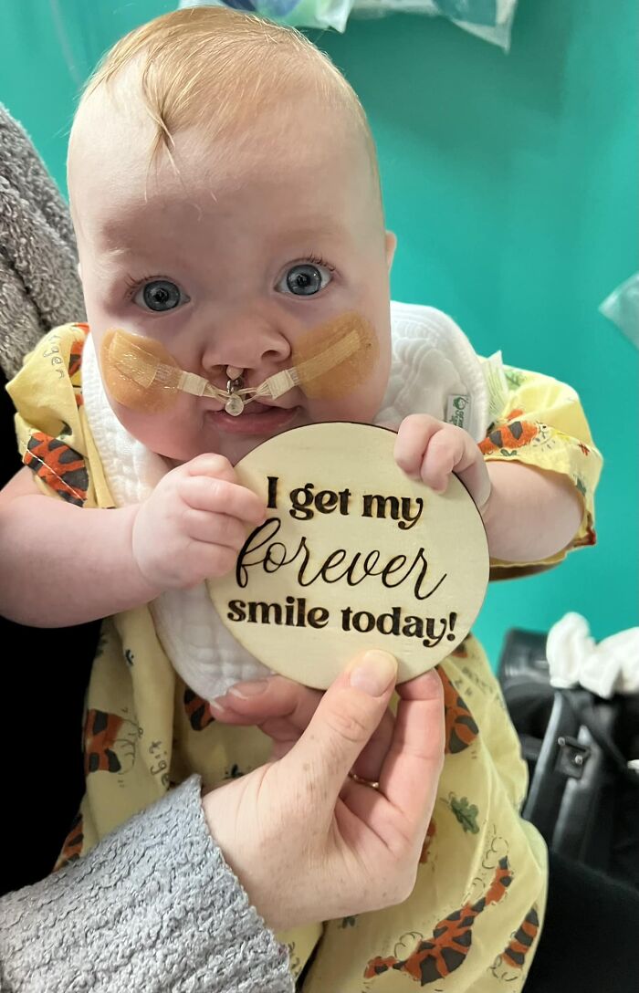The Heart-Warming Story Of One Photograph: An Image Of A Baby With A Cleft Lip, Making Her Story Go Viral