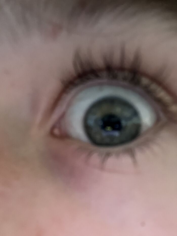 It’s Blurry Cuz Idk If Eyeballs Can Be Used To Steal My Identity Lol