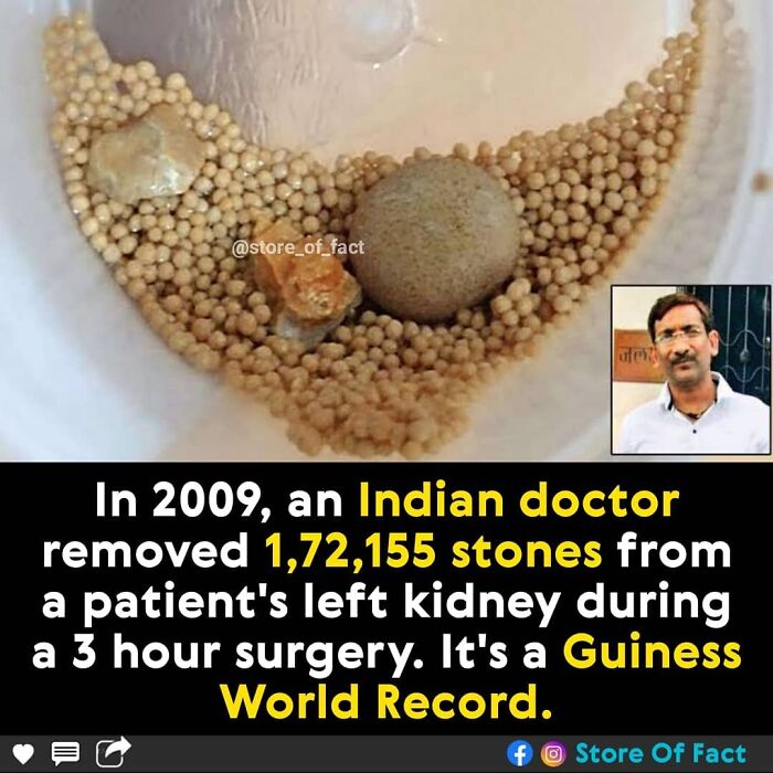 Store-Of-Crazy-Interesting-Facts