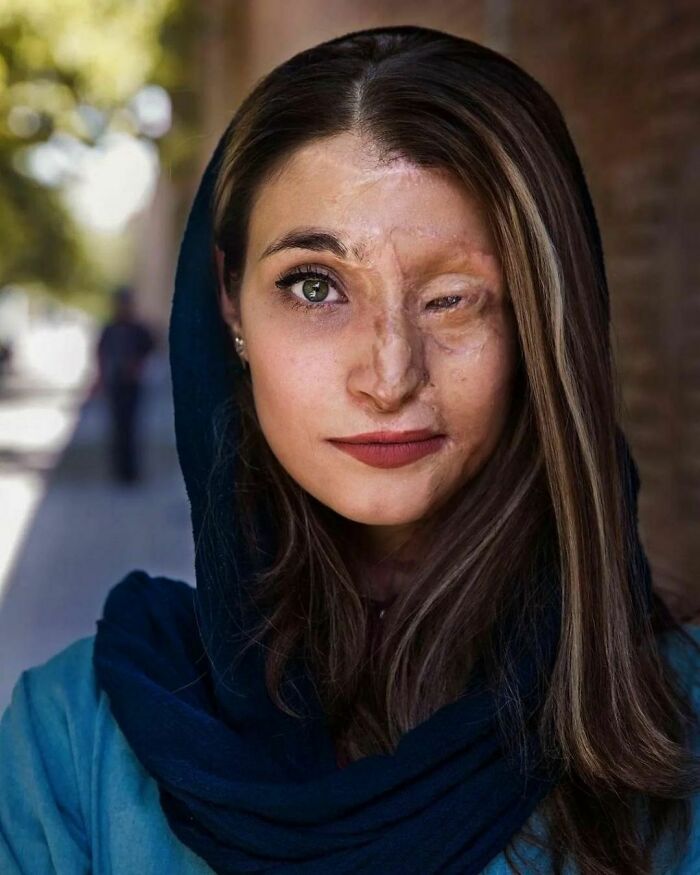 Power And Beauty, 2014. In 2014, A City In Iran Called Isfahan Was The Location Of A Number Of Brutal And Horrific Acid Attacks Against A Number Of Women