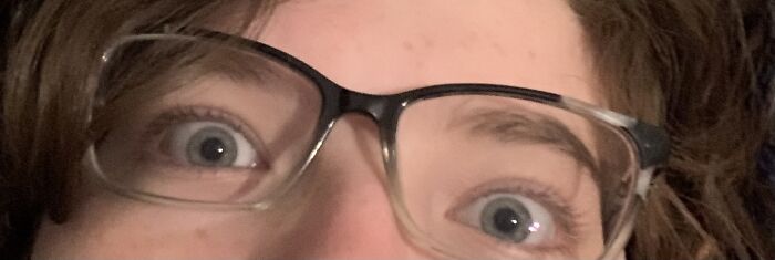 I Look So Silly Here. I Was Trying To Get A Picture But My Cat Was On My Face