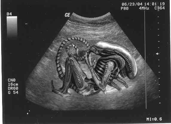 The-REAL-Ultrasound-6442cdfd68943.jpg