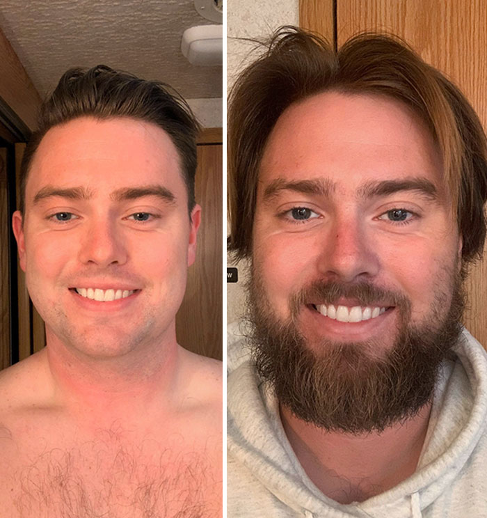 Aquí está mi progreso de 5 meses. Me encanta mi barba y mi pelo