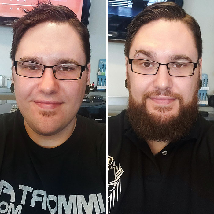 4 Month Before And After. I Haven't Grown A Beard Before, So I Was Feeling Pretty Accomplished