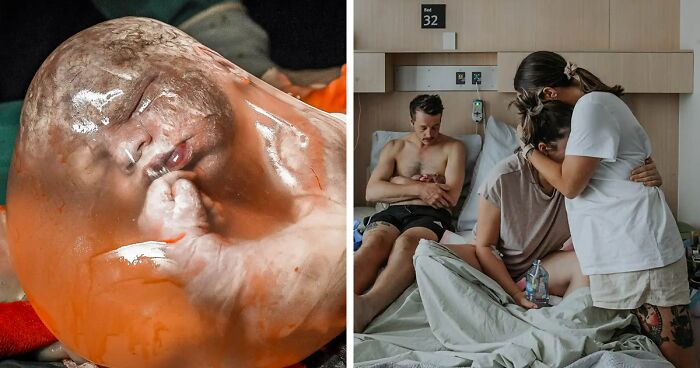 26 Touching Photos That Won The 2023 Birth Photography Image Competition