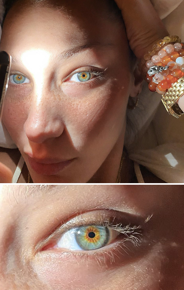 People Accused Bella Hadid Of Editing Her Eyes To Make Them Appear Bluer. It Is Visible That She Accidentally Colored Over A Small Part Of The White Of Her Eye