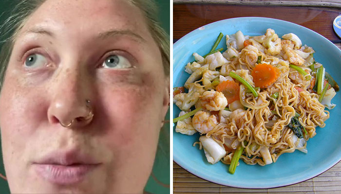 “Go Ahead And Call 911 Just In Case”: Server Confused As A Woman Claiming She’s ‘Allergic’ To Seafood Decides To Order Seafood Pasta