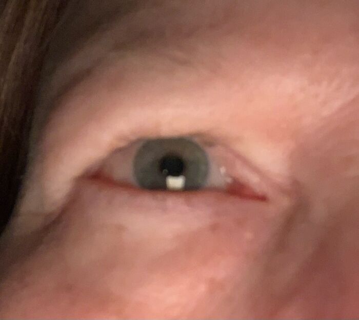 62 Year-Old Redhead Female