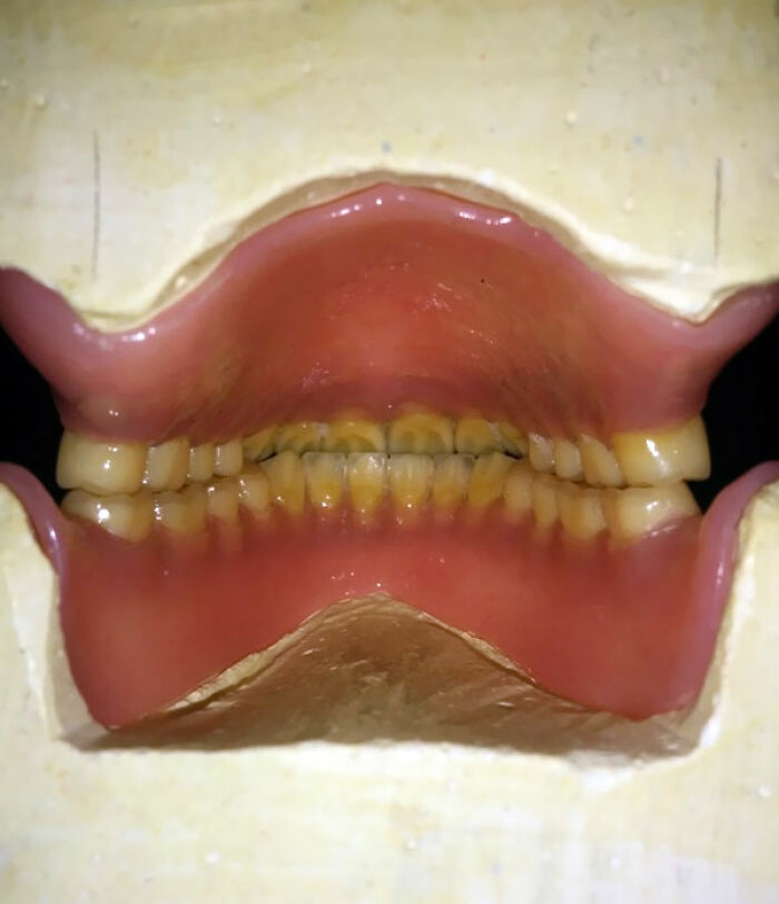 Dentition From The Inside