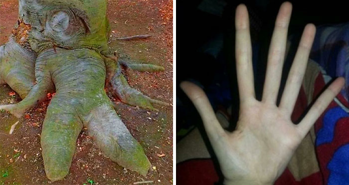 30 Pics That Might Make You Uncomfortable And Might Even Scare You