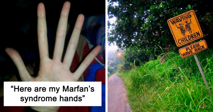 30 Pics That Might Make You Uncomfortable And Might Even Scare You