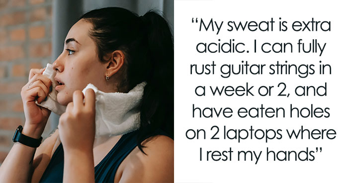 “My Feet Look More Like Paws Than Human Feet”: 35 People Confess What Body Anomalies They Have