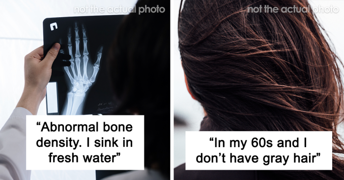 “My Feet Look More Like Paws Than Human Feet”: 35 People Confess What Body Anomalies They Have