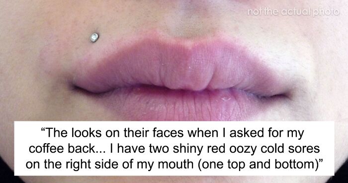 Teen Accepts A Dare To Drink From A Stranger’s Cup, Realizes She Has Herpes