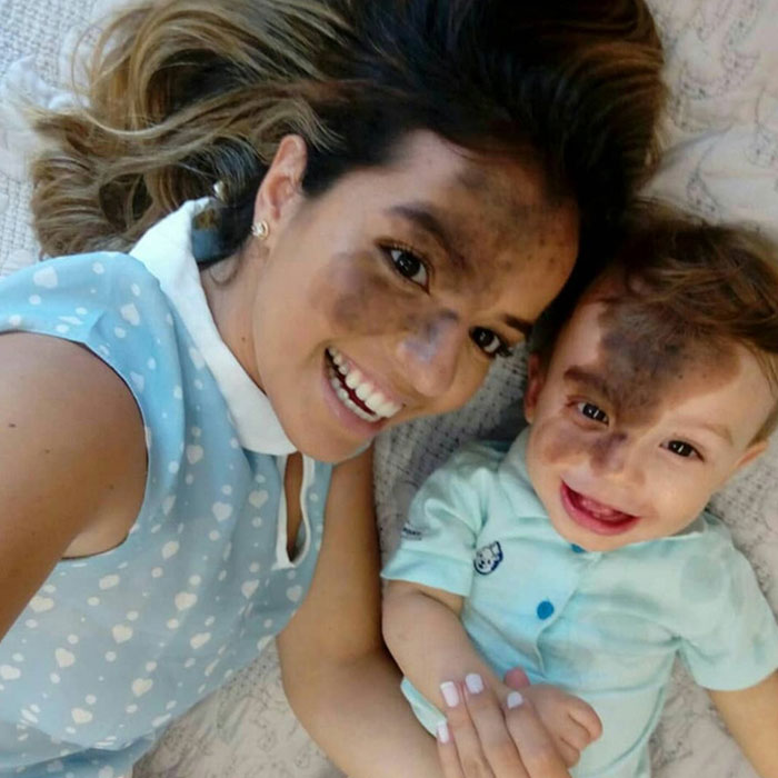 Una madre se pinta una gran marca de nacimiento en la cara para estar a juego con su hijo