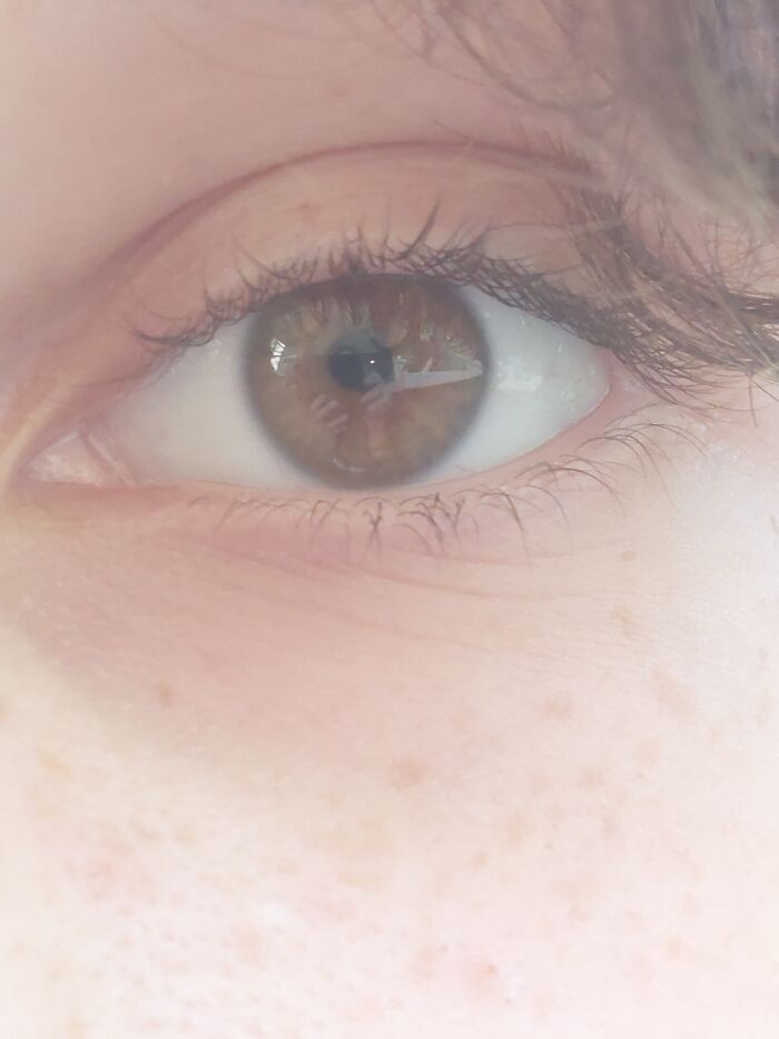 Ignore The Reflection, Have My Other Eye