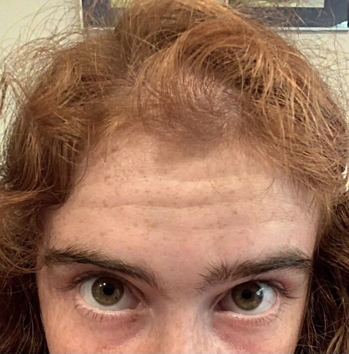 My Hair Is All Thin Up Front Now Cuz I Tug It But Oh Well