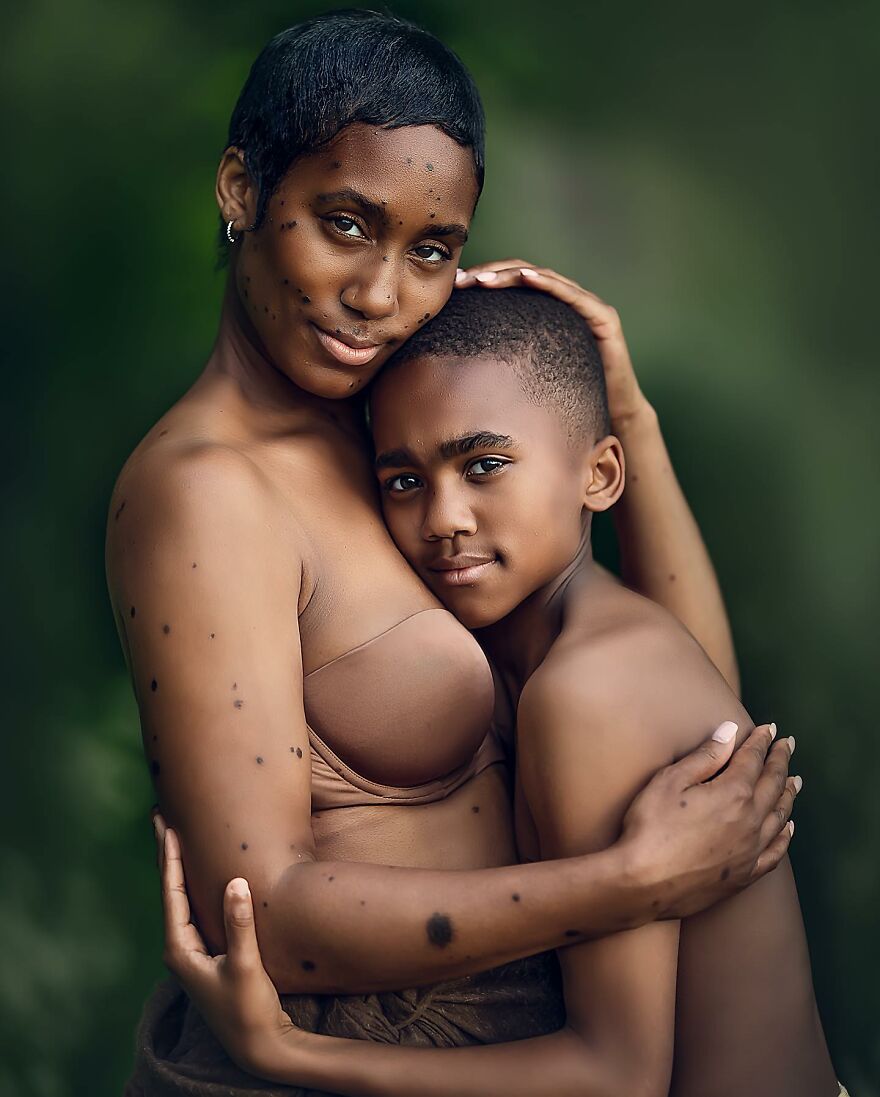 12 Heartwarming Stories Of People Who Overcame Their Differences